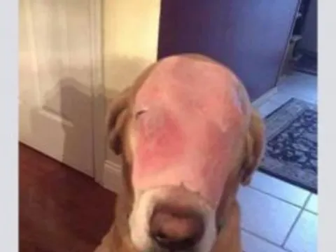 Burn Victim Ham